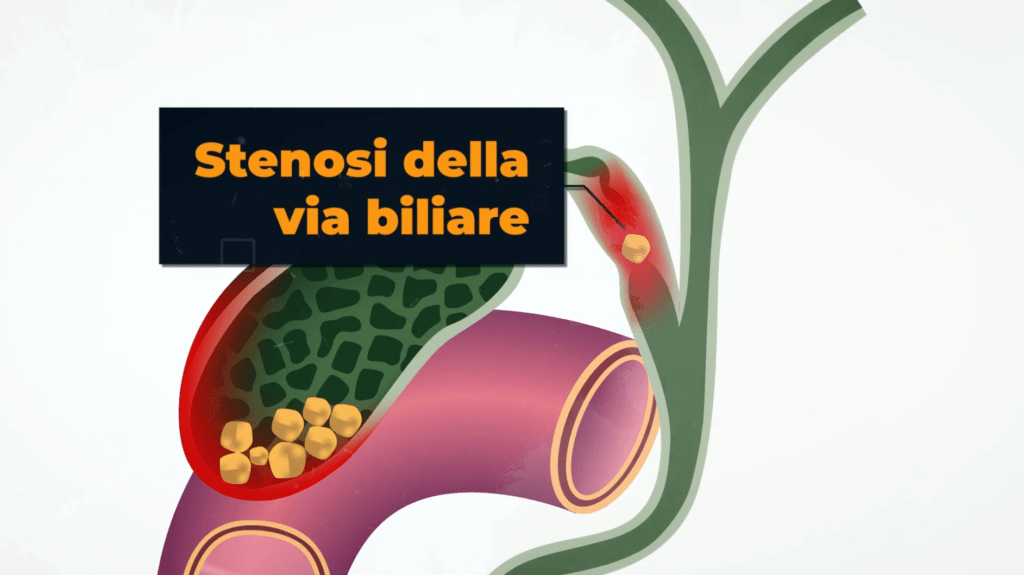 Quiz di medicina
